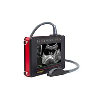 DRAMINSKI iScan 2 ເຄື່ອງສະແກນ Ultrasound (with 1 convex probe)