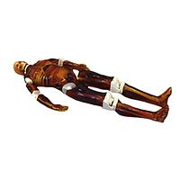 True Phantom Solutions FB-A03 ຮ່າງກາຍຜູ້ໃຫຍ່ທົ່ວໄປສໍາລັບ X-Ray CT, US