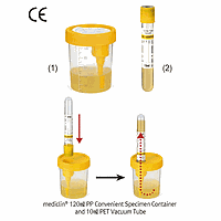 Daihan medical DM.Tub3001 ຫວັງວາກວັມ, ສໍາລັບຕົວຢ່າງນ້ຳປີ້, ມີຝາ PP, ປອດໄພ, 10㎖, Φ13×h106mm